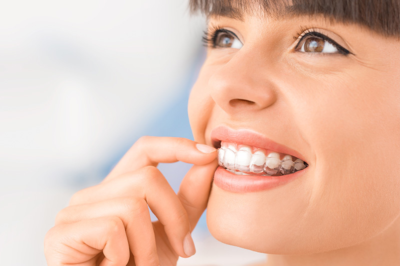 Teeth Straightening in Pittsfield