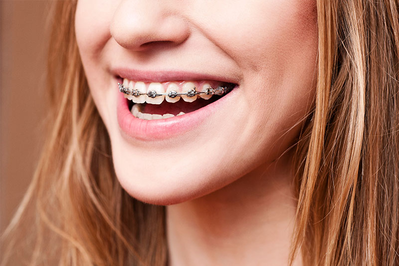 Orthodontics in Pittsfield